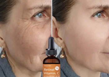 Top Benefits of Multi-Action Anti-Wrinkle Essence for Radiant, Youthful Skin