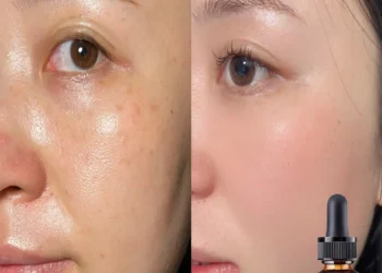 Top Benefits of Alcohol-Free Facial Oils for Sensitive Skin Hydration and Glow