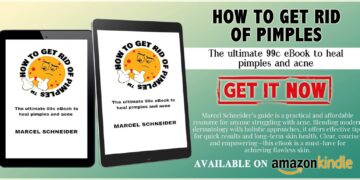 🔬 Professional Advice: Say Goodbye to Pesky Pimples! 🔬   